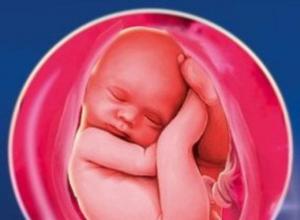 Varför uppstår oligohydramnios under graviditeten och behöver det behandlas?